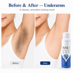 NNQ Hair Removal Spray For Men & Women